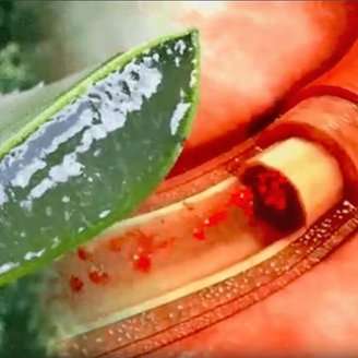 Drink This to Clean Your Blood Vessels and Lower Your Blood Pressure to 120/80 in Just 7 Days