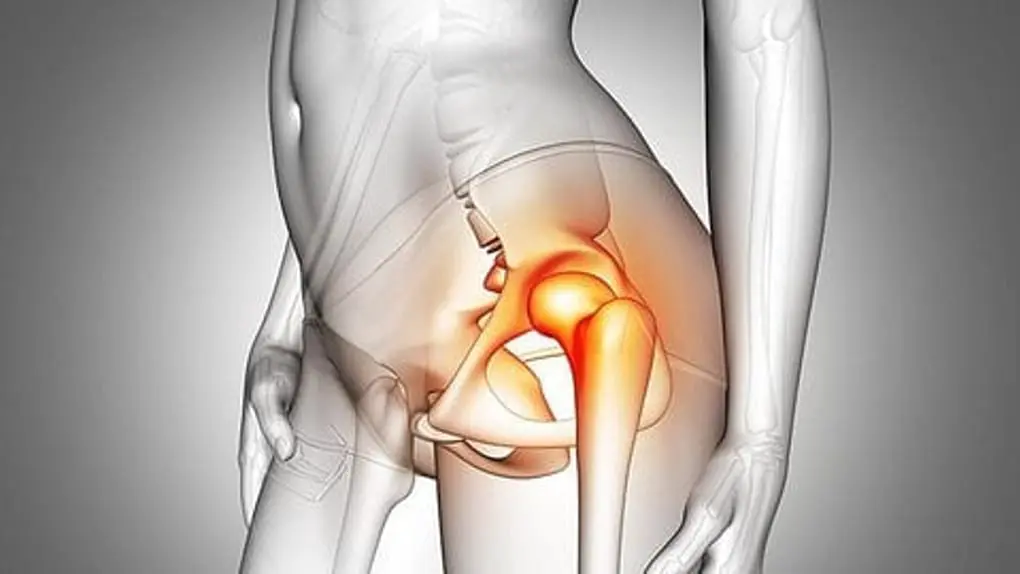 Relieve Knee and Hip Pain Naturally and Effectively