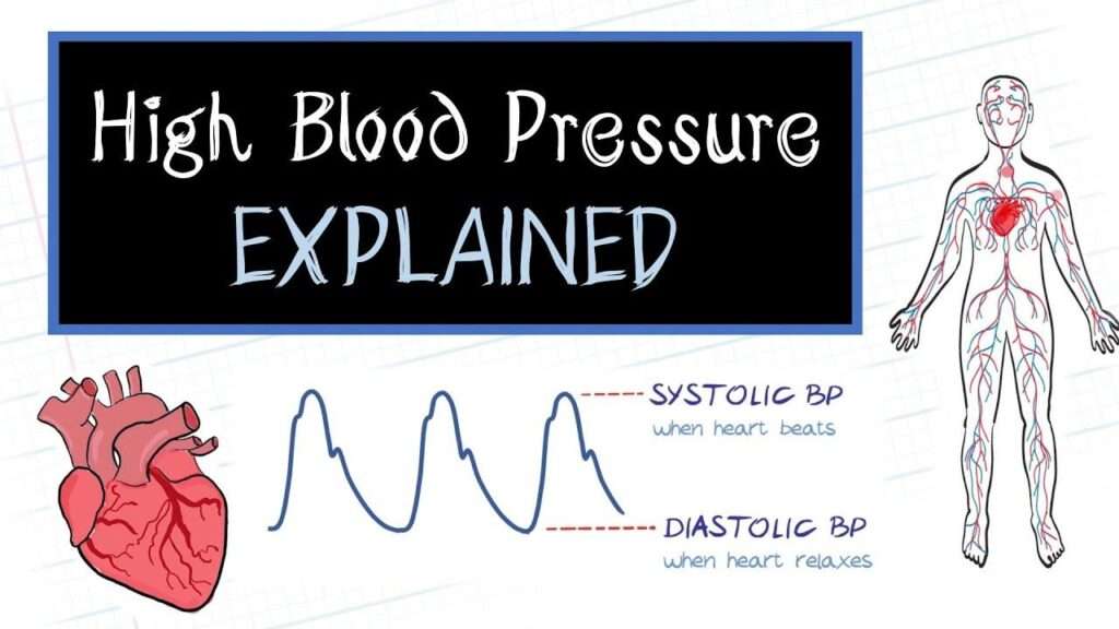 High Blood Pressure ( Hypertension ): Causes, Symptoms, Prevention and How to Fight It